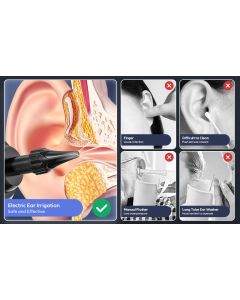 E30 Professional Electric Ear Irrigation and Ear Wax Removal Kit - Type-C Charging, 4 Pressure Levels, 200ML Tank & 10 Specialized Nozzles(9pcs 1-hole Nozzles & 1pcs 5-hole Nozzle)