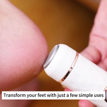 Electric Foot Callus Remover | USB Rechargeable