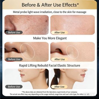 At-Home Facial Massager Beauty Device, 4-in-1 Microcurrent Face Lifting Tool with Red Light Therapy, Eye Care & Serum Infusion, Portable Skin Tightening Machine