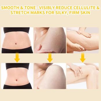 Electric Lymphatic Massager for Deep Cellulite and Body Massage with Display