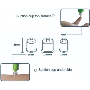 Venom Extractor Suction Tool for Insect Bites and Bee and Wasp Stings Free, Chemical Bite Relief