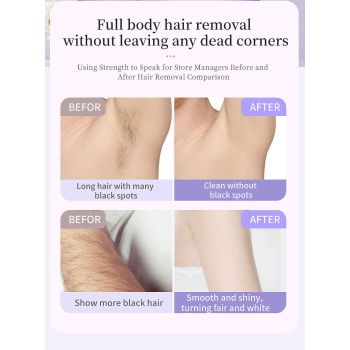 5-in-1 Electric Lady Shaver & Grooming Kit - LCD Display, USB-C Rechargeable, Full Body Hair Removal(White)