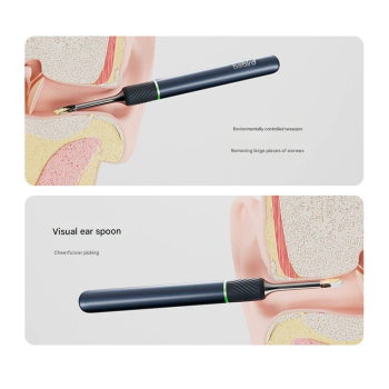 Smart Visual Ear Cleaner with HD Endoscope & Precision Tweezers - Safe for Adults & Children(White)